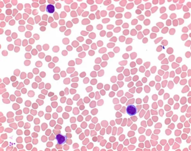 Azur-éosine-bleu de méthylène de Giemsa 1L
 