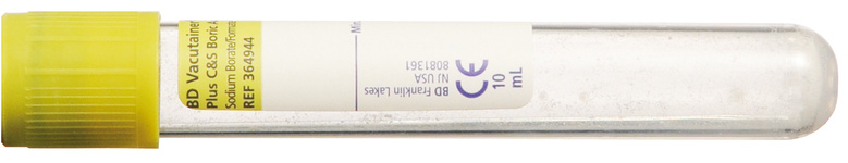 VACUTAINER Urin 10ml oliv Borsäure 50 Stk B13 